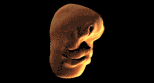 How a fetus's face forms. Wow.... &lt;MFW