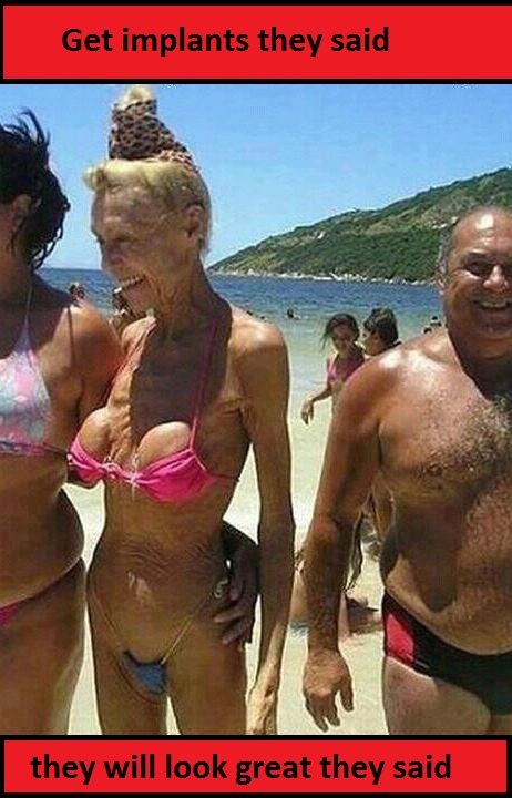 Age + implants = ugh. .. Well, i'm done with the internet. . .