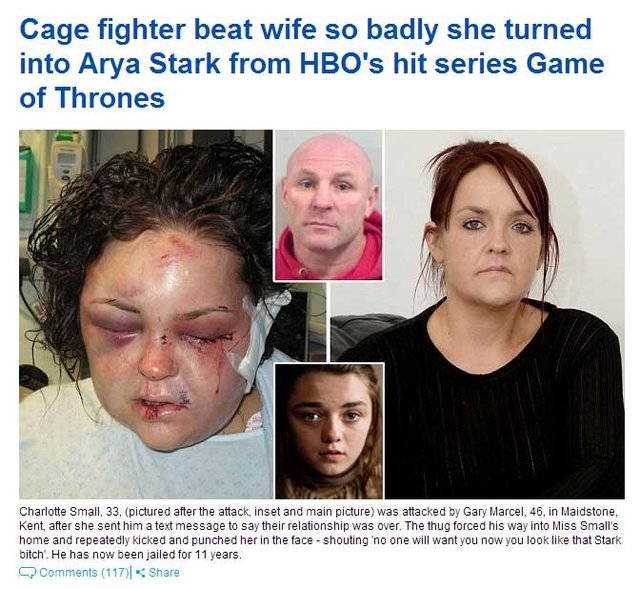 hue. . Cage fighter beat wife so badly she turned into Ania Stark from HBO' s hit series Game of Thrones tru- Charlotte Small, 33, (pictured after the attack. i
