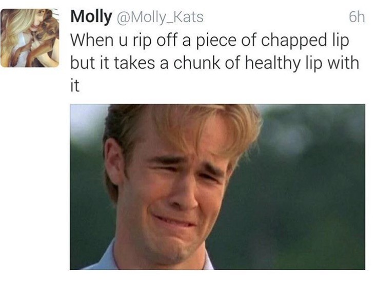 hurts. . Molly / When LI rip off a piece of chapped lip but it takes a chunk of healthy lip with