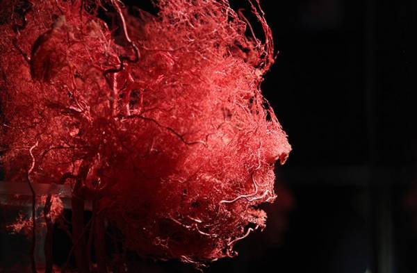 These are the blood vessels in your face. .. Fixed!