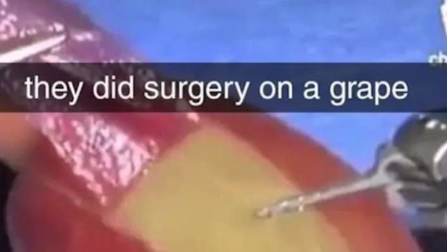 They did surgery on a grape. .. Nice to see internet explorer finally loaded up for you op
