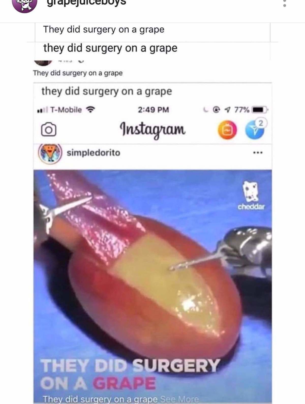 They did surgery on a grape. .. Revolver Ocelot