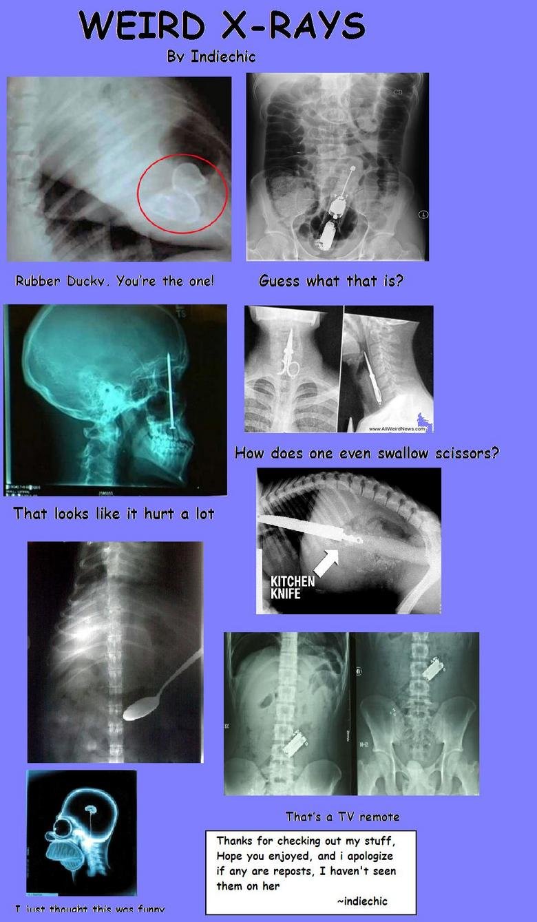 weird x-rays. just some funny stuff i found online. Bsr Thanks for checking out my stuff, Hope you enjoyed, and i apologize if any are reposts, I haven' t seen 