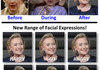 Hillary's Facelift