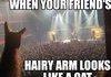Hairy Arm