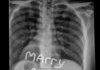How to propose to an X-Ray tech