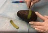 THEY DID SURGERY ON AN AVOCADO