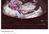 how i was born